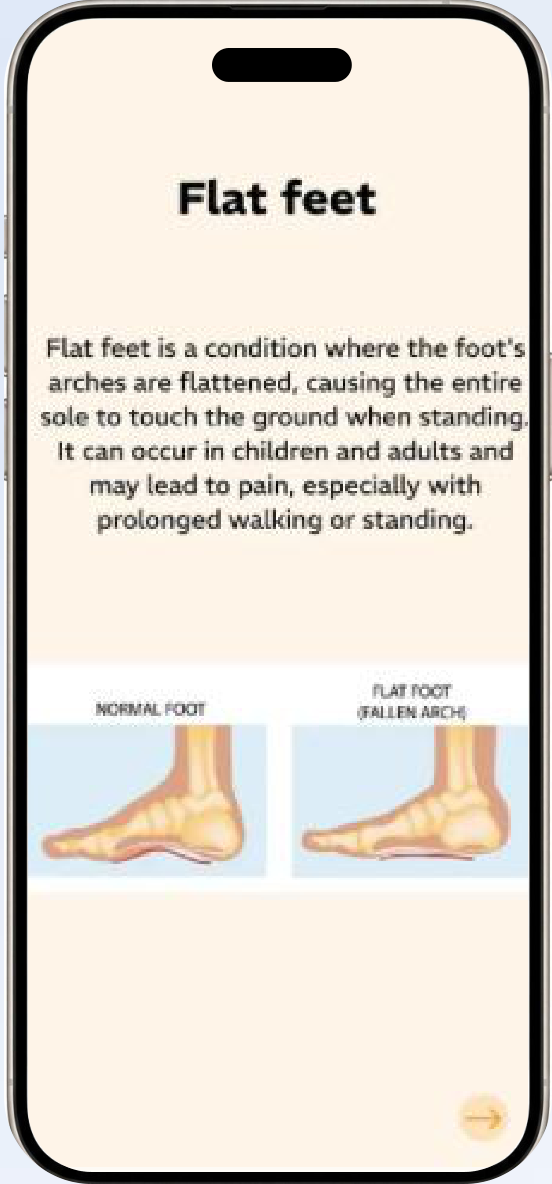 BMIF screen explaining flat feet