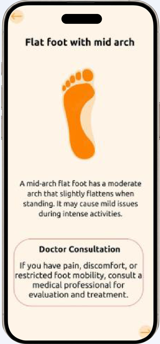 BMIF result screen showing a mid-arch flat foot